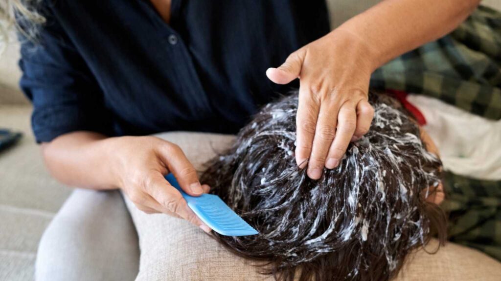 lice treatment diy at home messy application